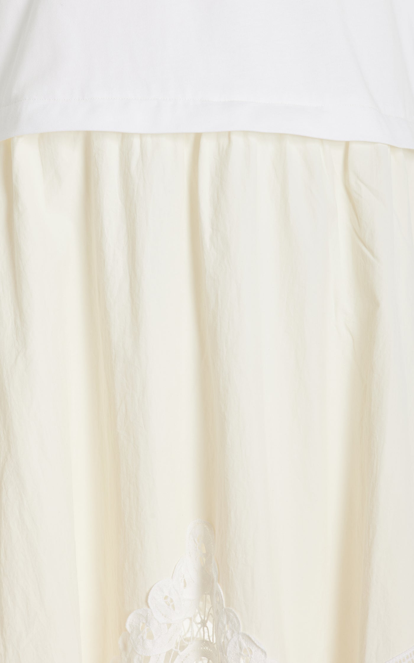 Anisley Windbreaker Cotton Midi Dress